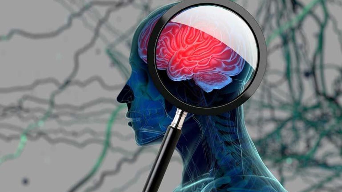 Alzheimer’a neden olabilecek nadir bir gen keşfedildi